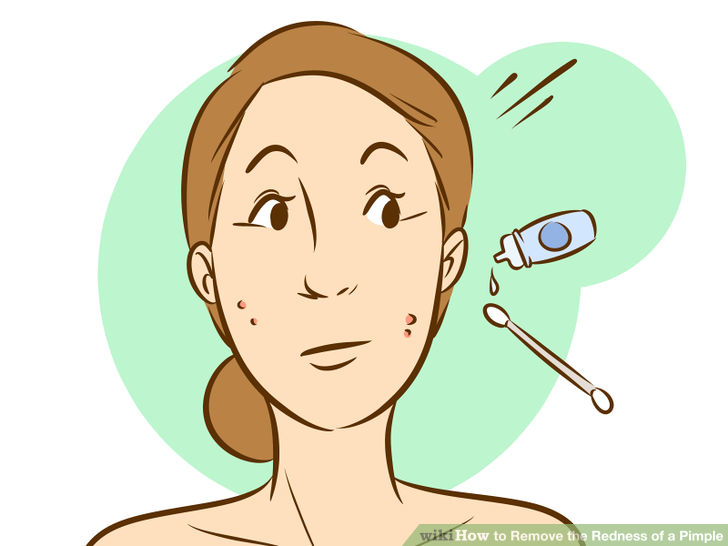 eyedrops to reduce redness